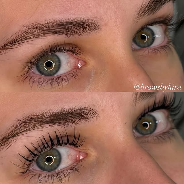 Beauty treatment 5
