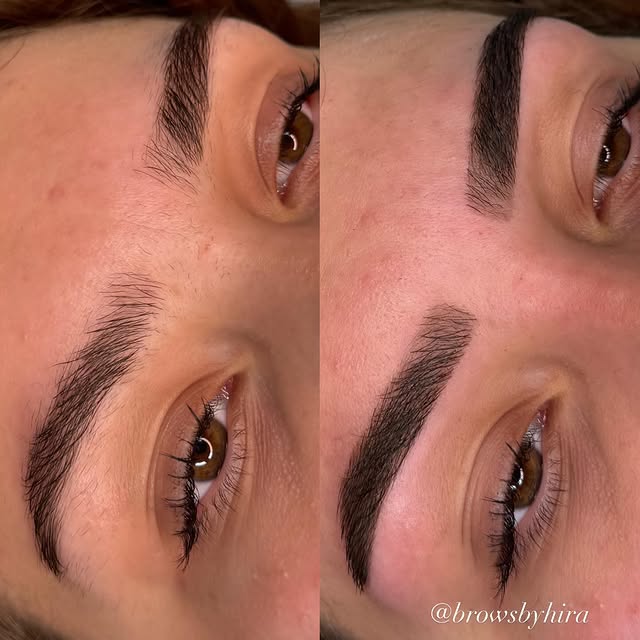 Beauty treatment 3