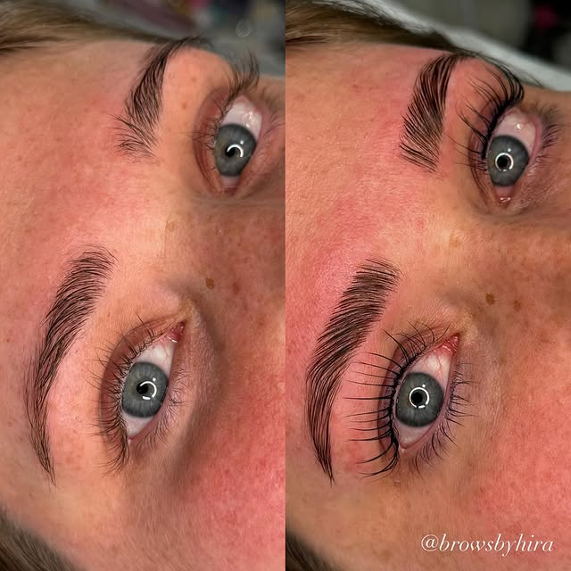 Beauty treatment 2