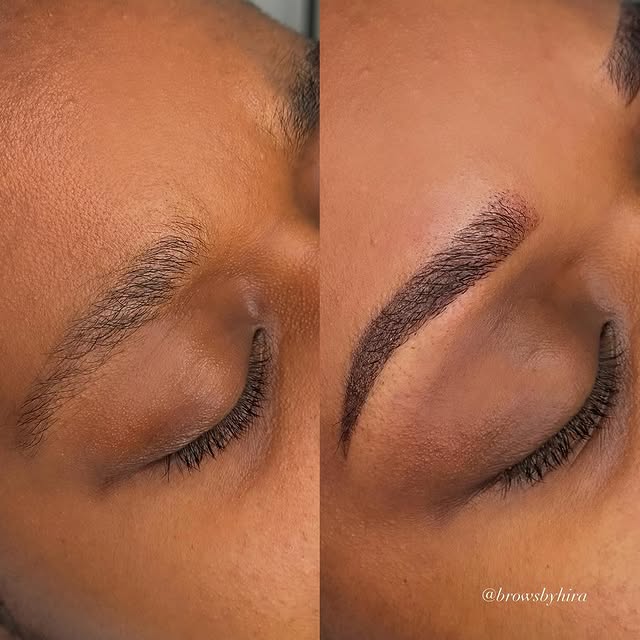 Beauty treatment 6
