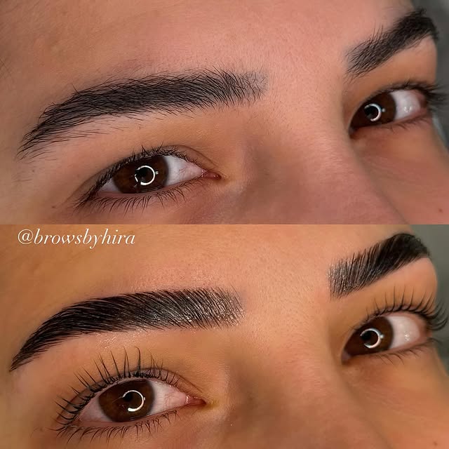 Beauty treatment 4
