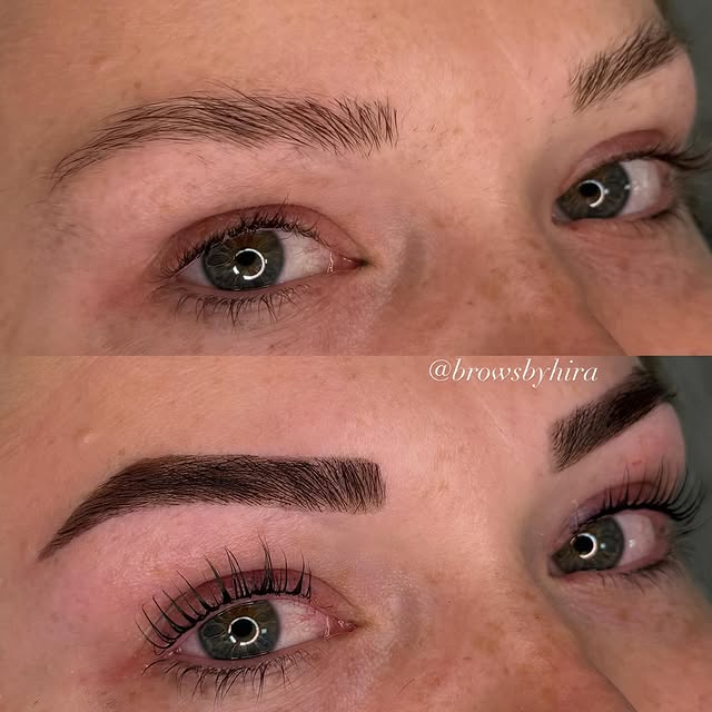 Beauty treatment 1